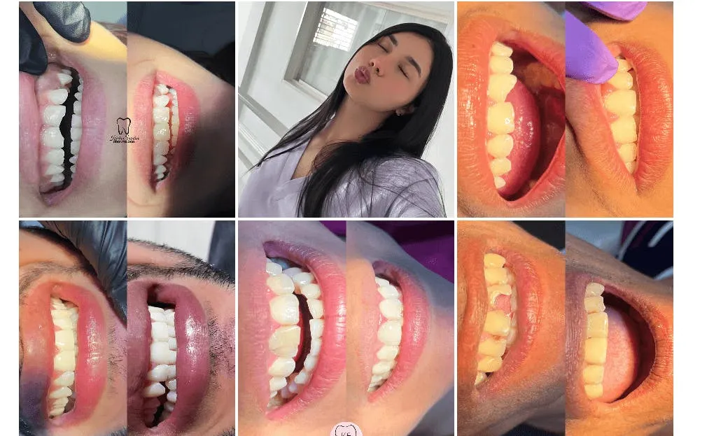 Odontólogo Karla Sarabia Socopó: Cuidado Dental Personalizado en Socopó